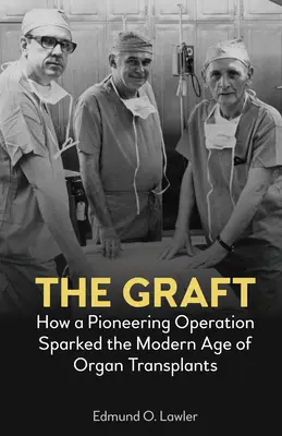 The Graft: Jak pionierska operacja zapoczątkowała współczesną erę przeszczepów narządów - The Graft: How a Pioneering Operation Sparked the Modern Age of Organ Transplants