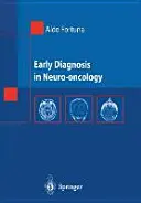 Wczesna diagnostyka w neuroonkologii - Early Diagnosis in Neuro-Oncology