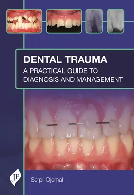 Urazy zębów: Praktyczny przewodnik po diagnostyce i leczeniu - Dental Trauma: A Practical Guide to Diagnosis and Management