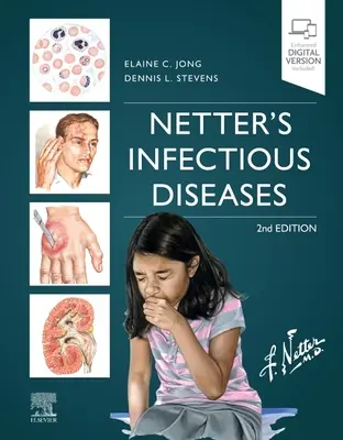 Choroby zakaźne Nettera - Netter's Infectious Diseases
