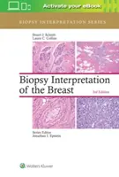 Interpretacja biopsji piersi - Biopsy Interpretation of the Breast