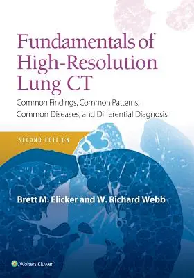 Podstawy tomografii komputerowej płuc o wysokiej rozdzielczości: typowe wyniki, typowe wzorce, typowe choroby i diagnostyka różnicowa - Fundamentals of High-Resolution Lung CT: Common Findings, Common Patterns, Common Diseases and Differential Diagnosis
