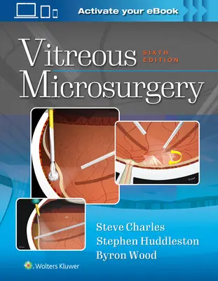 Mikrochirurgia ciała szklistego - Vitreous Microsurgery