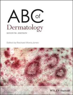 ABC dermatologii - ABC of Dermatology