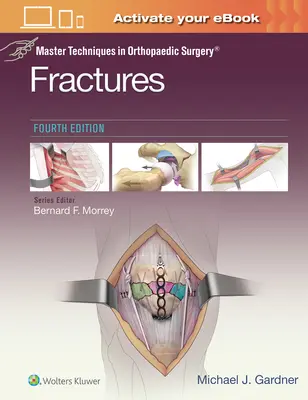 Mistrzowskie techniki w chirurgii ortopedycznej: Złamania - Master Techniques in Orthopaedic Surgery: Fractures