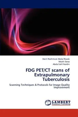 Skany FDG PET/CT gruźlicy pozapłucnej - FDG PET/CT scans of Extrapulmonary Tuberculosis