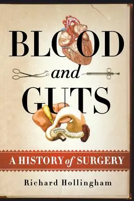 Krew i wnętrzności: Historia chirurgii - Blood and Guts: A History of Surgery