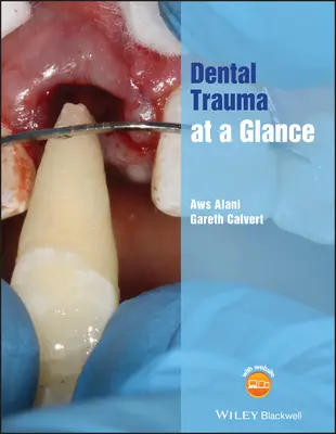 Uraz zębów w skrócie - Dental Trauma at a Glance