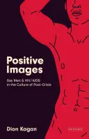 Pozytywne obrazy: Geje i HIV/AIDS w kulturze „postkryzysowej - Positive Images: Gay Men and Hiv/AIDS in the Culture of 'Post Crisis'