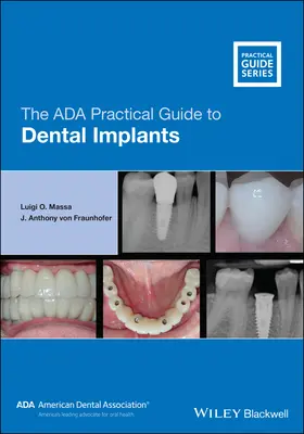 Praktyczny przewodnik ADA po implantach dentystycznych - The ADA Practical Guide to Dental Implants