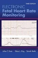 Elektroniczne monitorowanie tętna płodu: System 5-poziomowy: System 5-poziomowy - Electronic Fetal Heart Rate Monitoring: The 5-Tier System: The 5-Tier System