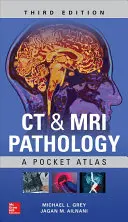 Patologia TK i MRI: Kieszonkowy atlas, wydanie trzecie - CT & MRI Pathology: A Pocket Atlas, Third Edition