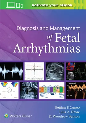 Diagnostyka i leczenie zaburzeń rytmu serca u płodu - Diagnosis and Management of Fetal Arrhythmias
