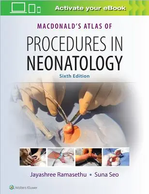 Atlas procedur Macdonalda w neonatologii - Macdonald's Atlas of Procedures in Neonatology