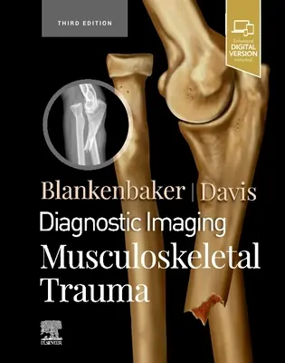 Obrazowanie diagnostyczne: Urazy mięśniowo-szkieletowe - Diagnostic Imaging: Musculoskeletal Trauma