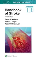 Podręcznik udaru mózgu - Handbook of Stroke