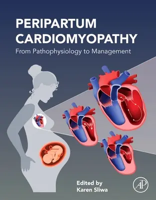 Kardiomiopatia okołoporodowa: Od patofizjologii do zarządzania - Peripartum Cardiomyopathy: From Pathophysiology to Management