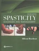 Spastyczność: Diagnoza i zarządzanie - Spasticity: Diagnosis and Management