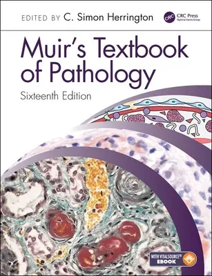 Podręcznik patologii Muira - Muir's Textbook of Pathology