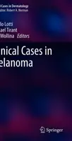 Przypadki kliniczne czerniaka - Clinical Cases in Melanoma