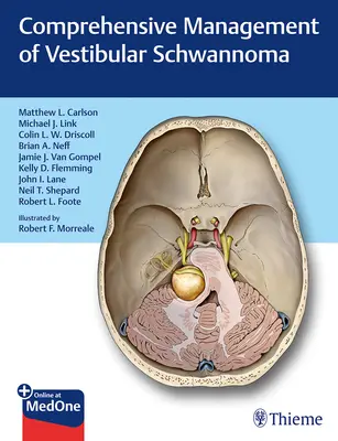 Kompleksowe leczenie nerwiaka przedsionkowego - Comprehensive Management of Vestibular Schwannoma