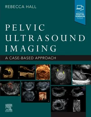 Obrazowanie ultrasonograficzne miednicy: Podejście oparte na przypadkach - Pelvic Ultrasound Imaging: A Cased-Based Approach