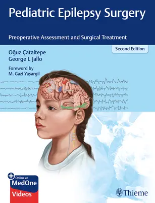 Chirurgia padaczki dziecięcej: Ocena przedoperacyjna i leczenie chirurgiczne - Pediatric Epilepsy Surgery: Preoperative Assessment and Surgical Treatment