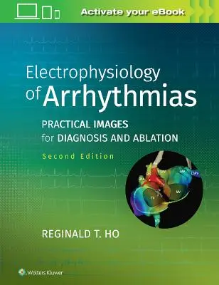 Elektrofizjologia arytmii: Praktyczne obrazy diagnostyki i ablacji - Electrophysiology of Arrhythmias: Practical Images for Diagnosis and Ablation