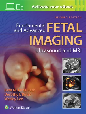 Podstawowe i zaawansowane obrazowanie płodu za pomocą ultrasonografii i rezonansu magnetycznego - Fundamental and Advanced Fetal Imaging Ultrasound and MRI