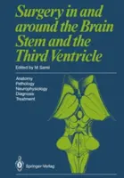 Chirurgia w obrębie pnia mózgu i trzeciej komory: Anatomia - Patologia - Neurofizjologia Diagnoza - Leczenie - Surgery in and Around the Brain Stem and the Third Ventricle: Anatomy - Pathology - Neurophysiology Diagnosis - Treatment