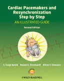 Rozruszniki serca i resynchronizacja krok po kroku: Ilustrowany przewodnik - Cardiac Pacemakers and Resynchronization Step by Step: An Illustrated Guide