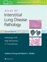 Atlas patologii śródmiąższowych chorób płuc - Atlas of Interstitial Lung Disease Pathology