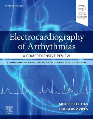 Elektrokardiografia arytmii: Kompleksowy przegląd - Electrocardiography of Arrhythmias: A Comprehensive Review