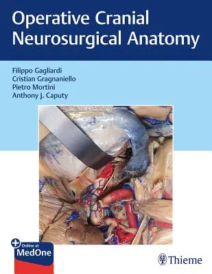 Operacyjna anatomia neurochirurgiczna czaszki - Operative Cranial Neurosurgical Anatomy