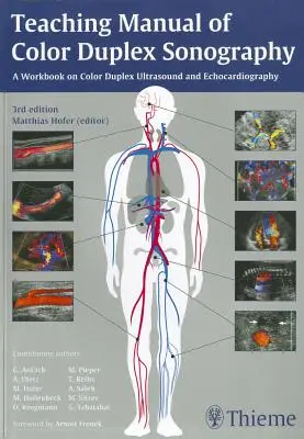 Podręcznik do nauki kolorowej ultrasonografii dupleksowej - Teaching Manual of Color Duplex Sonography
