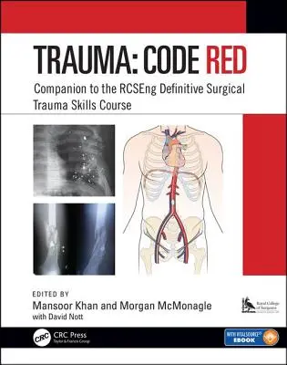 Uraz: Code Red: Towarzysz kursu Rcseng Definitive Surgical Trauma Skills Course - Trauma: Code Red: Companion to the Rcseng Definitive Surgical Trauma Skills Course