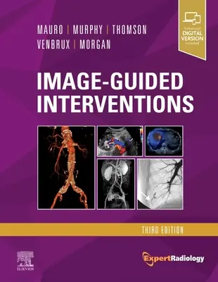 Interwencje kierowane obrazem: Expert Radiology Series - Image-Guided Interventions: Expert Radiology Series