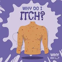 Dlaczego mnie swędzi? - Why Do I Itch?