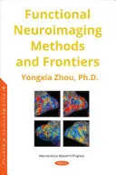 Funkcjonalne metody i granice neuroobrazowania - Functional Neuroimaging Methods and Frontiers