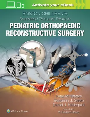 Ilustrowane porady i wskazówki Boston Children's dotyczące dziecięcej ortopedycznej chirurgii rekonstrukcyjnej - Boston Children's Illustrated Tips and Tricks in Pediatric Orthopaedic Reconstructive Surgery