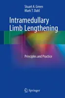 Śródszpikowe wydłużanie kończyn: Zasady i praktyka - Intramedullary Limb Lengthening: Principles and Practice