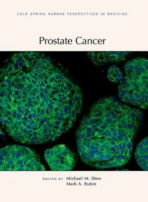 Rak prostaty - Prostate Cancer