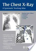 The Chest X-Ray: A Systematic Teaching Atlas
