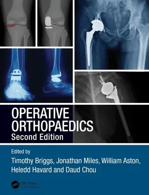 Ortopedia operacyjna - Operative Orthopaedics