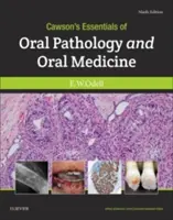 Cawson's Essentials of Oral Pathology and Oral Medicine (Podstawy patologii i medycyny jamy ustnej) - Cawson's Essentials of Oral Pathology and Oral Medicine