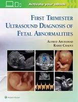 Diagnostyka ultrasonograficzna nieprawidłowości płodu w pierwszym trymestrze ciąży - First Trimester Ultrasound Diagnosis of Fetal Abnormalities