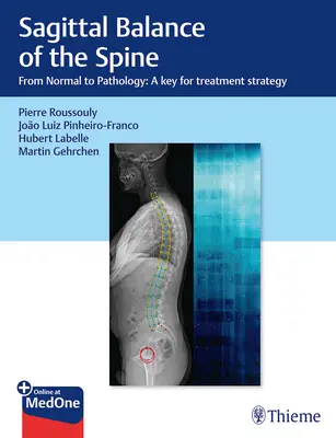 Równowaga strzałkowa kręgosłupa: Od normy do patologii: Klucz do strategii leczenia - Sagittal Balance of the Spine: From Normal to Pathology: A Key for Treatment Strategy