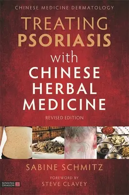 Leczenie łuszczycy chińską medycyną ziołową (wydanie poprawione): Praktyczny podręcznik - Treating Psoriasis with Chinese Herbal Medicine (Revised Edition): A Practical Handbook