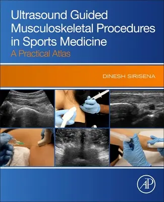 Ultrasonograficzne procedury mięśniowo-szkieletowe w medycynie sportowej - praktyczny atlas - Ultrasound Guided Musculoskeletal Procedures in Sports Medicine - A Practical Atlas