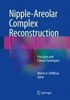 Rekonstrukcja kompleksu brodawka-otoczka: Zasady i techniki kliniczne - Nipple-Areolar Complex Reconstruction: Principles and Clinical Techniques